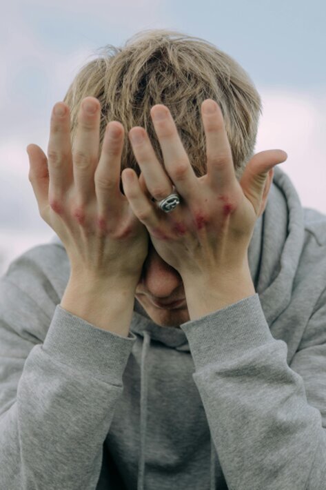 Man wearing a hoodie with his head in his hands in despair
